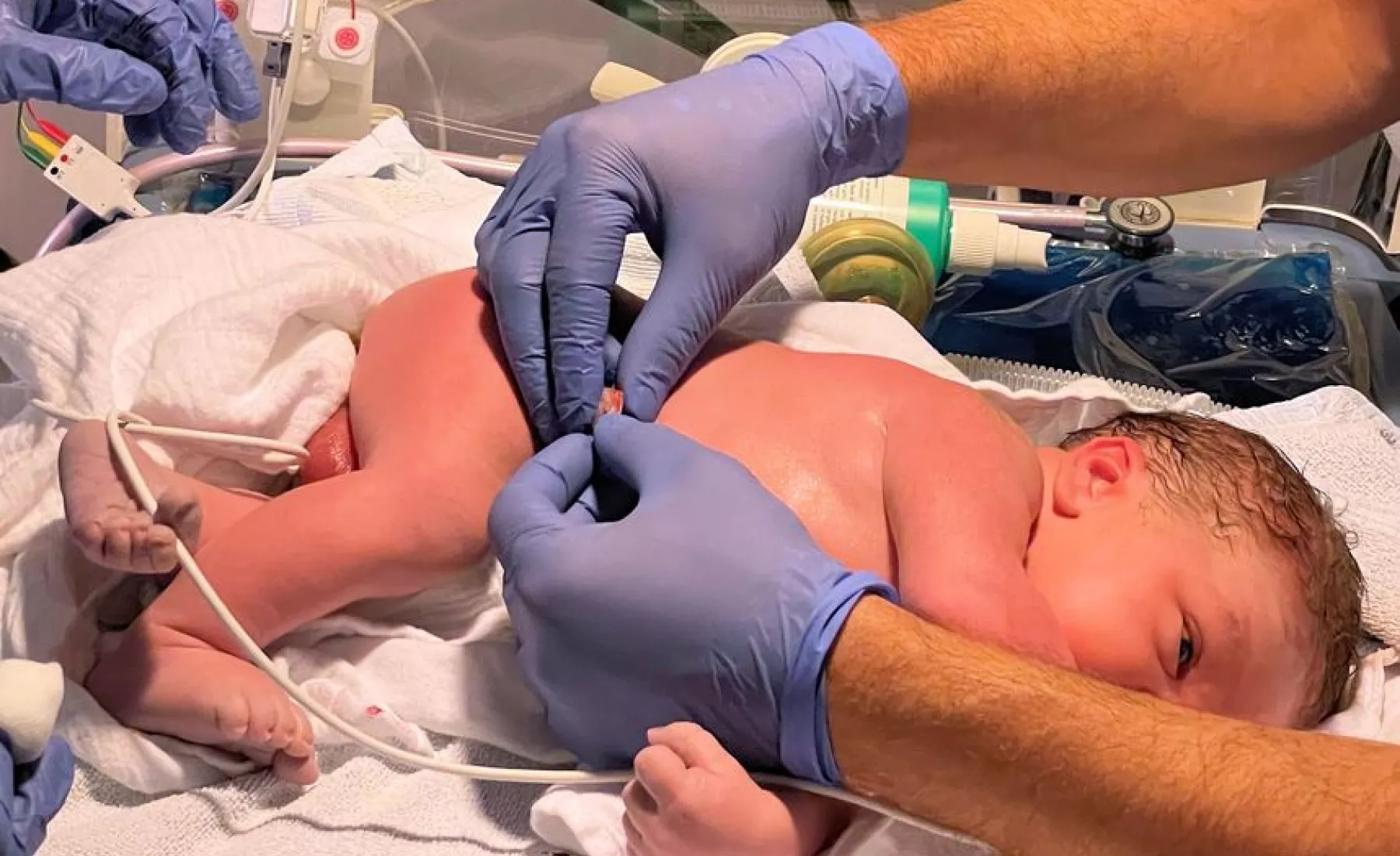 Ein Säugling wird unmittelbar nach der Geburt in der Neonatologie des Wernigeröder Harzklinikums untersucht.